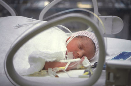 Prematüre doğumlar artıyor